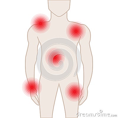 Body Parts Pain Illustration with Aches Vector Illustration