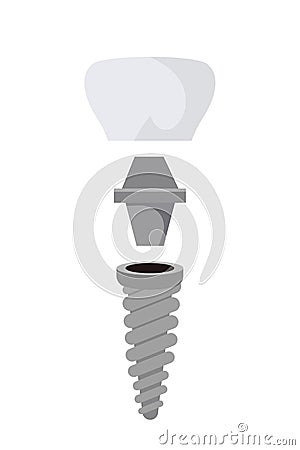 Bolts, screws and tooth prosthesis dentistry set Vector Illustration