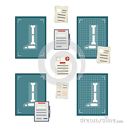 Bone fracture. Internal organ x-ray. Broken foot and leg. Vector Illustration