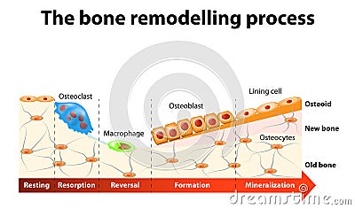 Bone remodelling process Vector Illustration