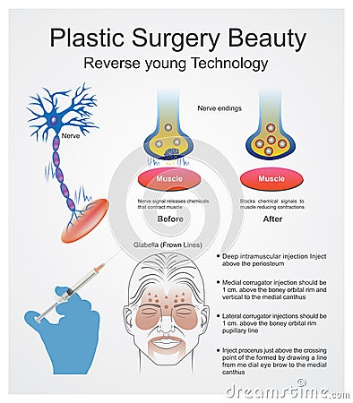 Plastic surgery beauty. Reverse young technology. Vector Illustration