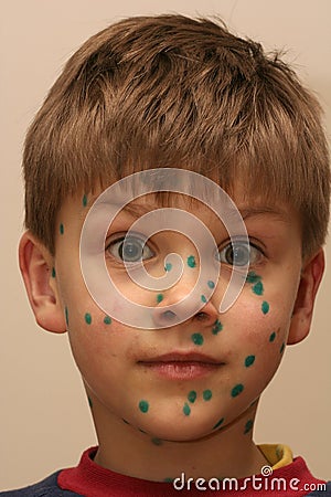 Boy with Green Dots Stock Photo