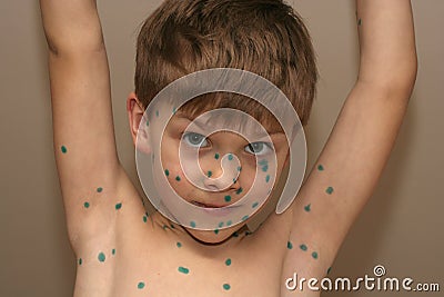 Boy with Green Dots Stock Photo