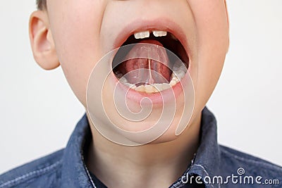 Boy, kid opened his mouth, oral cavity, close-up teeth, performs articulation exercises for the tongue, vocals, dental concept, Stock Photo