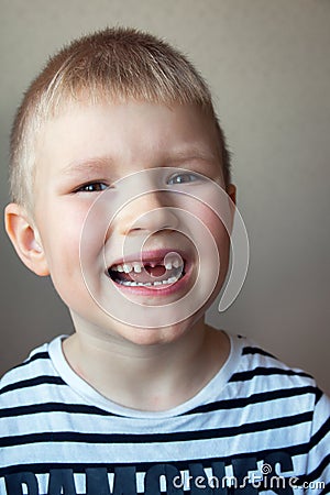 Boy missing milk teeth Stock Photo