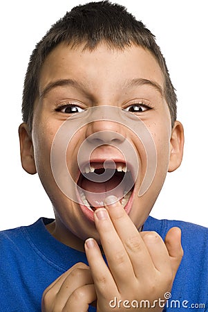 Boy missing teeth Stock Photo