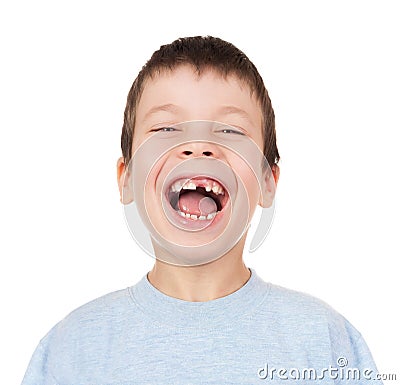 Boy portrait with a lost tooth Stock Photo