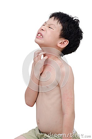 Boy scratching his allergic skin Stock Photo