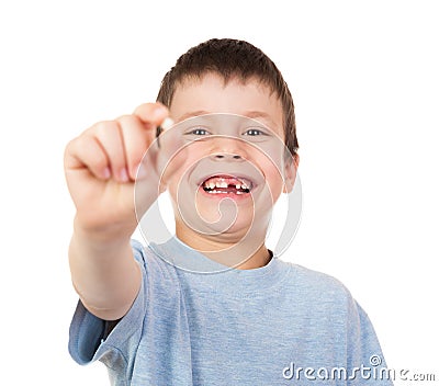 Boy show a lost tooth Stock Photo