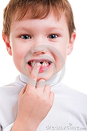 Boy showing his missing milk teeth Stock Photo