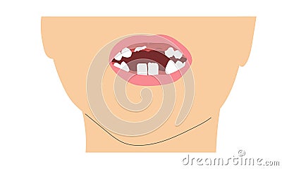 A boy smile missing tooth due to change of milk teeth. Simple minimalistic illustration of baby mouth with incomplete Vector Illustration