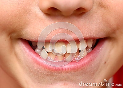 Boy smile with strong white teeth photo Stock Photo