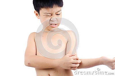 Boy wound Stock Photo