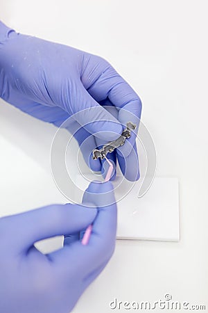 Braces in the hands of an orthodontist. Unrecognizable person. Vertical photo. The concept of health. Hands in protective gloves. Stock Photo