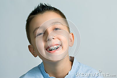 Braces Stock Photo