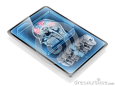 Brain activity scan Stock Photo