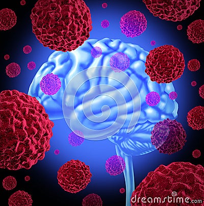 Brain Cancer Stock Photo