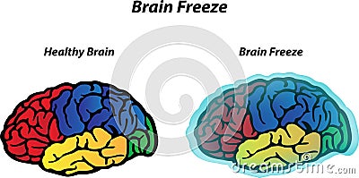 Brain Freeze Vector Illustration