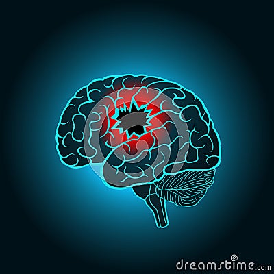 A brain with a hole, the concept of destruction of the brain, memory, stroke Vector Illustration