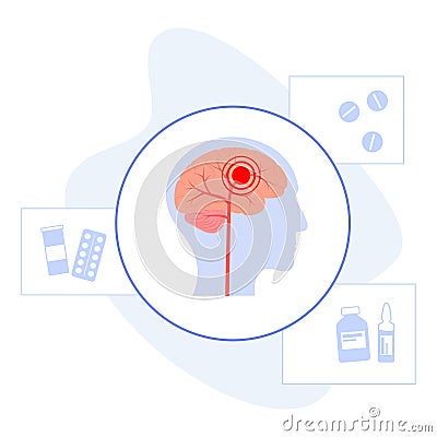 Brain pain disease Vector Illustration