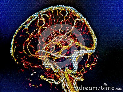 brain veins, CT illustration Cartoon Illustration