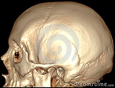 Brain sagital 3D CT Cartoon Illustration