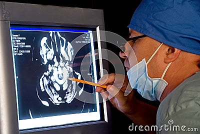 Brain Scan Stock Photo