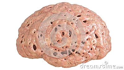 Brain in severe brain disease, Dementia, Alzheimer, Chorea Huntington - 3D Rendering Stock Photo