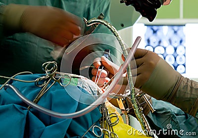 Brain surgery Stock Photo