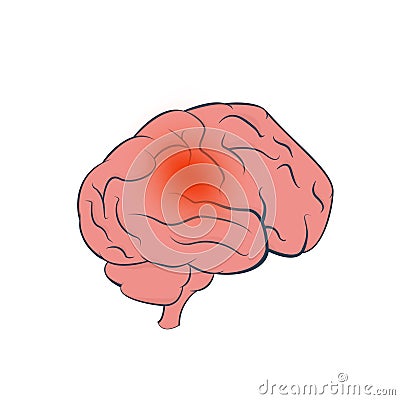 Brain tumor vector design Vector Illustration