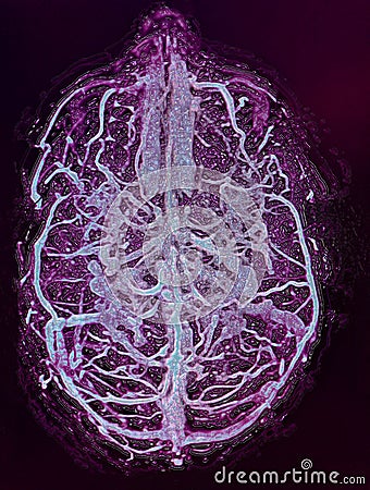 brain veins illustration, MRI Stock Photo