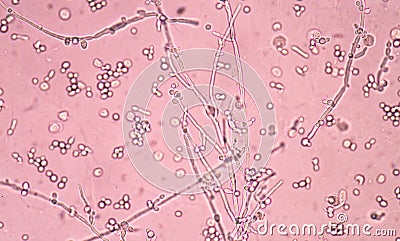 Branching budding yeast cells Stock Photo