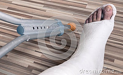 Broken ankle in gypsum Stock Photo