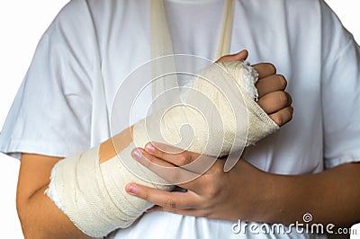 Broken Arm Stock Photo