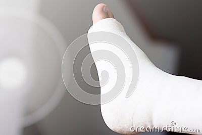 Broken bone Stock Photo