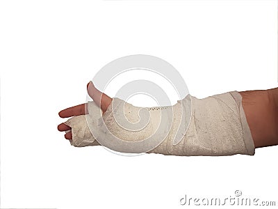 Broken hand plaster. right hand. male. isolated Stock Photo