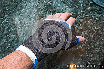 Broken Thumb Stock Photo