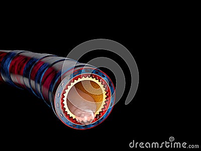 Bronchitis anatomy, mucus secreted as a chest cold as a 3D illustration Cartoon Illustration