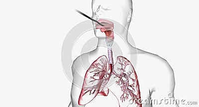 Bronchoscopy is an invasive procedure used to look inside the respiratory system Stock Photo