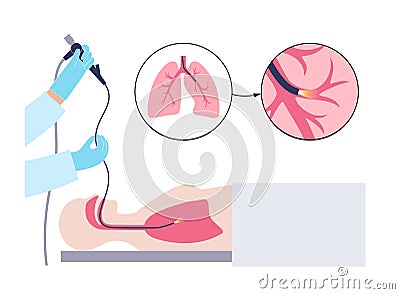 Bronchoscopy procedure concept Vector Illustration