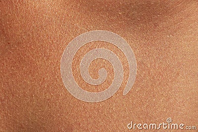 Brown human skin texture. Sunburned woman skin closeup Stock Photo
