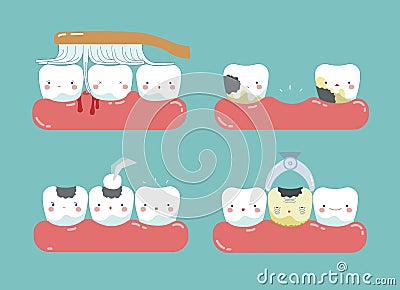 Brushing make hurt gum and teeth, decayed teeth ,filling tooth of dental set Vector Illustration