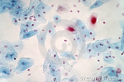 Buccal mucosa cell under the light microscope view Stock Photo