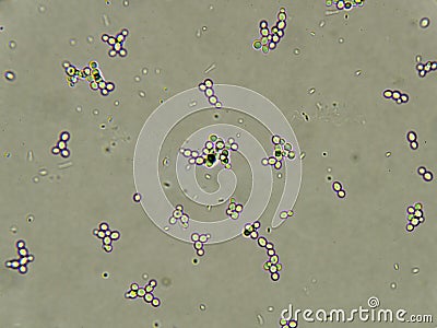 Budding yeast cells Stock Photo