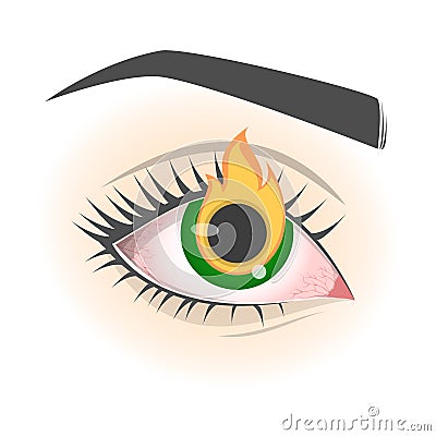 Burning eye feeling. Conjunctivitis disease, red eyeball. Vision Vector Illustration