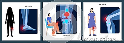 Bursitis inflammation concept Vector Illustration