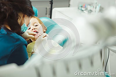 Calm child in dental office allows the dentist to examine teeth. Boy is treated for caries. Stock Photo