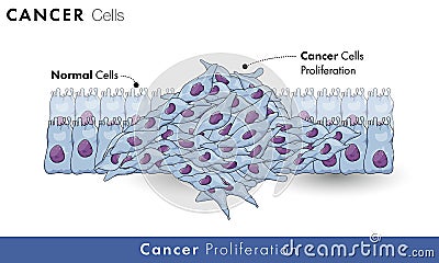 Cancer cell proliferation mechanism with normal cells in the background vector design Stock Photo