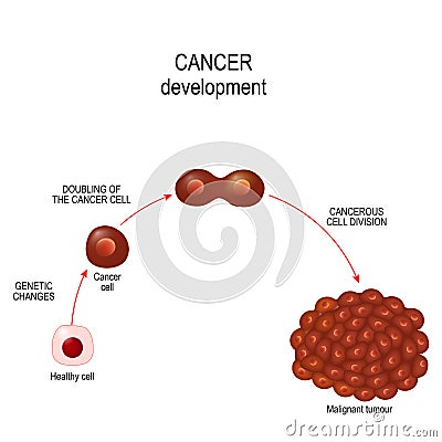 Cancer cell. illustration showing cancer disease development. Vector Illustration
