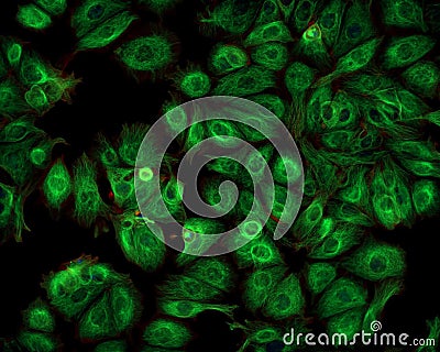 Cancer cells imaged with a fluorescence microscope Stock Photo